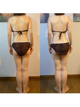 ララルアナ(Lara luana)/バストケア　背面の変化