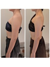 ワイズ(Y's)/背中&二の腕　14回目