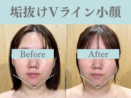 フローフシ∞の写真