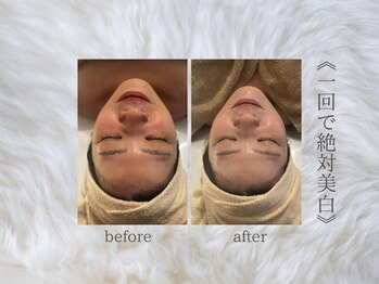 ジュプン 長崎/復元パックのお客様！