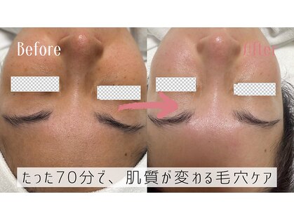 ナチュラ ソース(NatureSouce)の写真