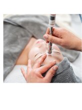 ヴィナーレ(VINARE)/角質ケア