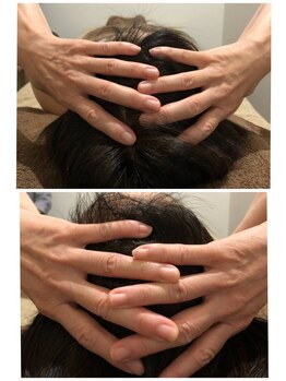 吉川美南ライフ整骨院/60代女性