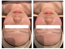 チェンジ(Change)/