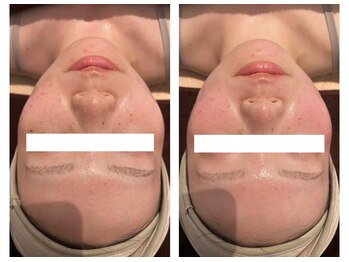 チェンジ(Change)/