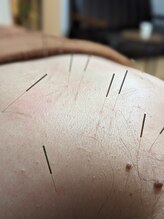 乃々鍼灸整体院 表参道/鍼灸×整体