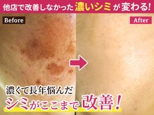 サロンドエステケイワイ(de KY)