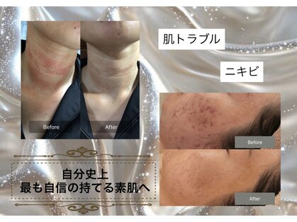 ティーズキッス(T’s Kiss)の写真