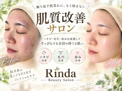 リンダ(Rinda)の写真