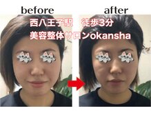 美容整体サロン オオカンシャ(okansha)/一度の施術で小顔に！