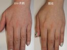 加齢な手！ふっくら艶もちに☆