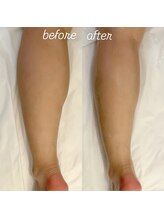 グレアージュ(GLEAGE)/