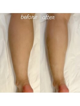 グレアージュ(GLEAGE)/