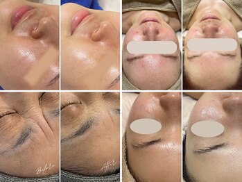 ボーテニスタ(BEAUTE NISTA)