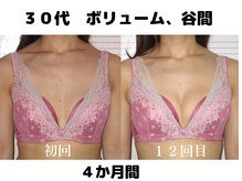 バストサロン メルベイユ(Merveile)の雰囲気（デコルテ、谷間ふっくらボリュームUP♪１２回、４ヶ月）