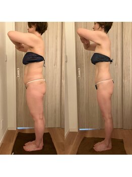 レジュベール(Rejuvel)/ゆっくり痩せたい方！