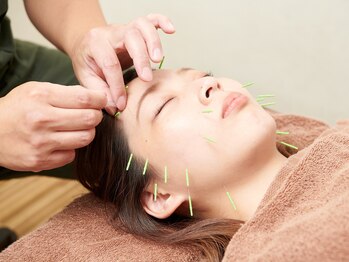 リライフ鍼灸整骨院 十条院/美容鍼灸