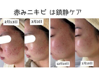 クレア(Claire)の写真