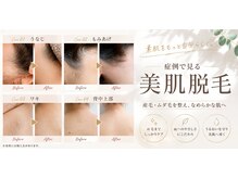 ノンノン(NonNon)の雰囲気(2種の光だから、スベスベまでが速い)