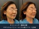 イロハ(IROHA)の写真/年齢を感じない若々しいお顔へ*年齢を重ねるたびに気になるお顔のたるみに!エステ以上の仕上がりをご提供♪