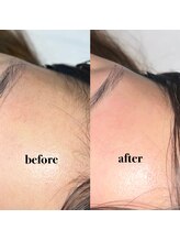 ルーナ 南与野(luna)/おでこｗａｘ