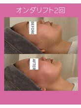 シーズ(C'ies)/脂肪燃焼オンダリフト