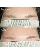サロンロン 横浜関内(SALON RON)/眉毛/美容電気脱毛