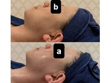 シャルム(CHARME)/REDショット