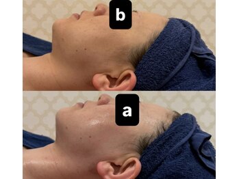 シャルム(CHARME)/REDショット