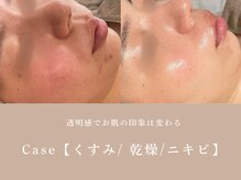 シーヴォーク(Cveauque)/クリスティーナ｜アンストレス