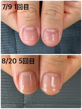 ピュアティネイル(purity nail)/最強ネイルケア