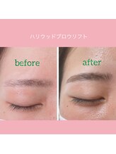 フェリーチェ(felice)/ハリウッドブロウリフト