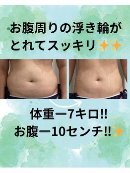 エデン(Eden)/お腹周り集中★本気の痩身