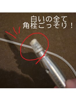 シュウア(SyuA)/こんなに毛穴汚れが！