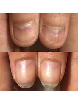 カンパニュラ(Campanula)/自爪育成コース