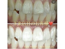 ライトビューティー 本八幡店(LIGHT BEAUTY)/【セルフホワイトニング】