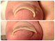 フットケアサロン ラビフット(Rabbi foot)の写真