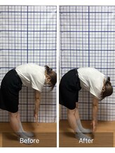 幸鍼灸整体院 武庫之荘院/整体・トレーニング・姿勢変化15