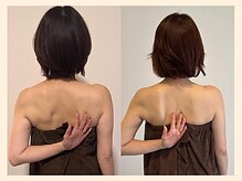 ラフリー 武蔵小杉院(RUFFREE)/肩こり改善に肩甲骨はがし