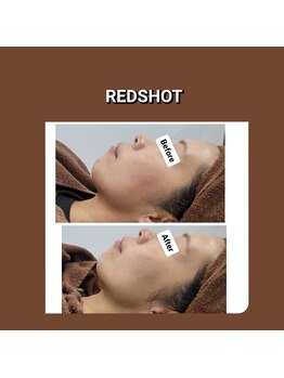 イージープラス 古河店(EASY+)/話題の!!REDSHOT