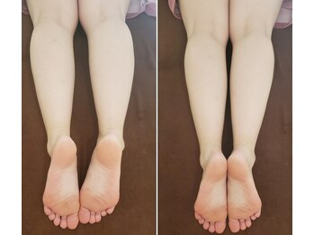 サロン柚の木の写真/日々の疲れや浮腫みもスッキリ解消!本格コルギ×美容整体で、憧れの美脚ラインへ♪