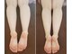 サロン柚の木の写真/日々の疲れや浮腫みもスッキリ解消!本格コルギ×美容整体で、憧れの美脚ラインへ♪