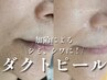 加齢によるシワたるみはコレ!即効性No 1艶肌になる《ダクトピール》/45分