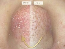 アンダンテ(Andante)
