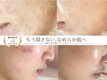 ソワンドビジュー(soin de bijew)
