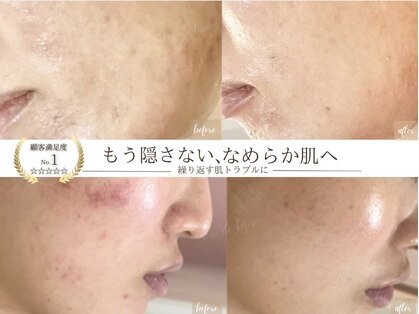ソワンドビジュー(soin de bijew)の写真