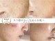 ソワンドビジュー(soin de bijew)の写真