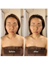 パピヨン(papillon)/ビフォーアフター