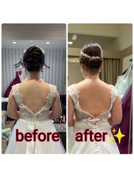 フレクシー/ブライダル　痩身／痩身エステ