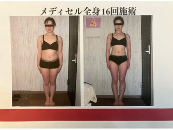 おひさま松本整骨院/